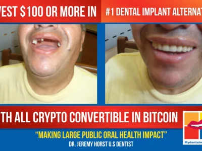 MYDENTALWIG OFFICIAL CROWDFUNDING CAMPAIGN IN 3 LANGUAGES