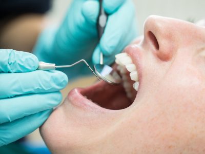 HOW TO UNDERSTAND THE SUCCESS RATE FOR DENTAL IMPLANTS?