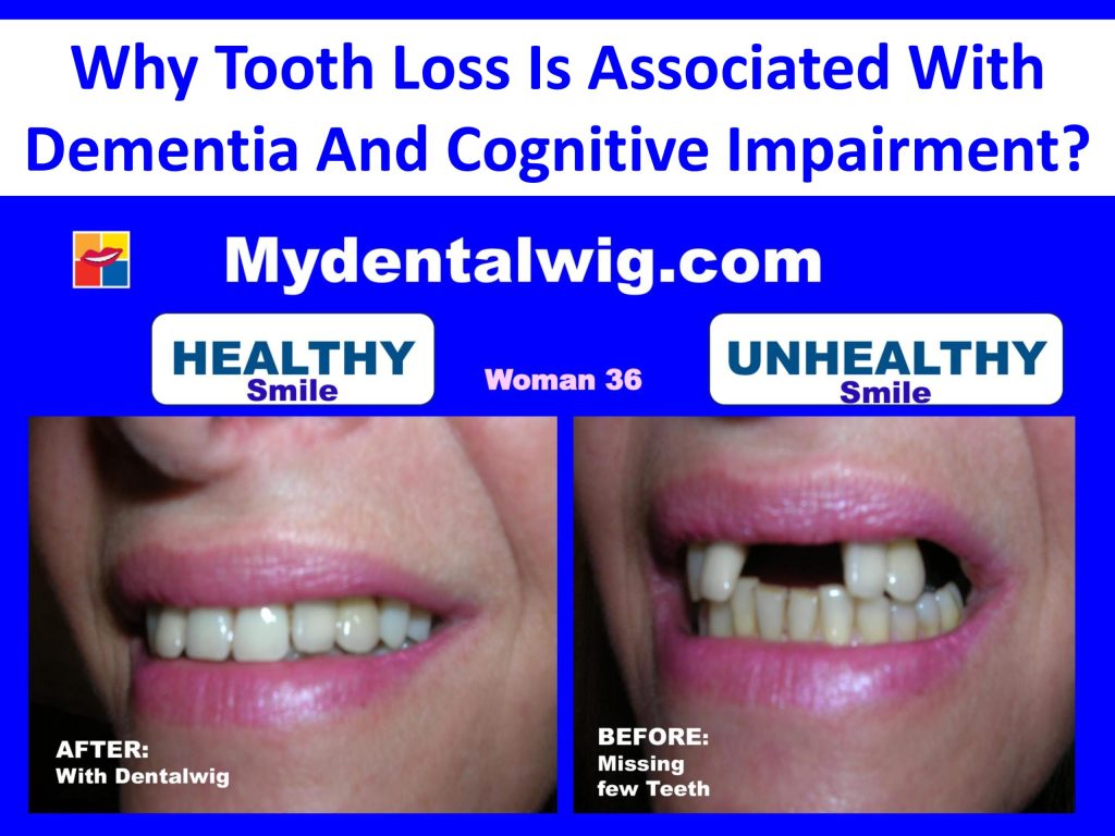 Mydentalwig's image of with and without dentalwig